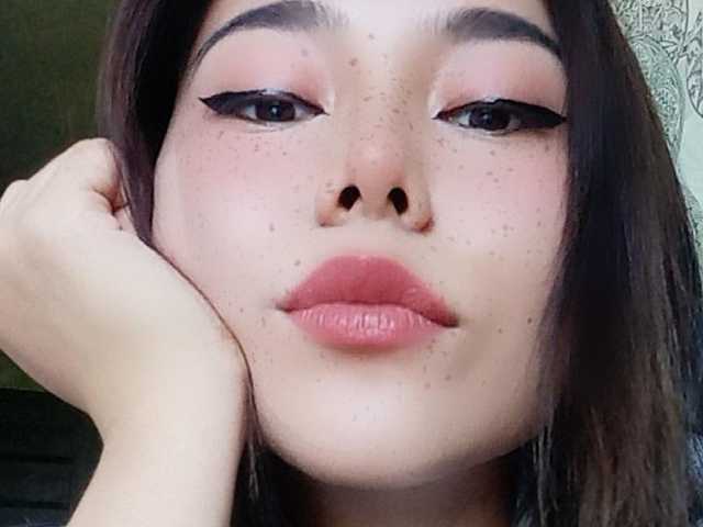 תמונה של הפרופיל amylin