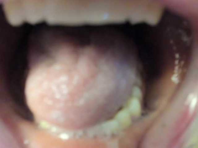 צילומי מסך משודרים spellmananto